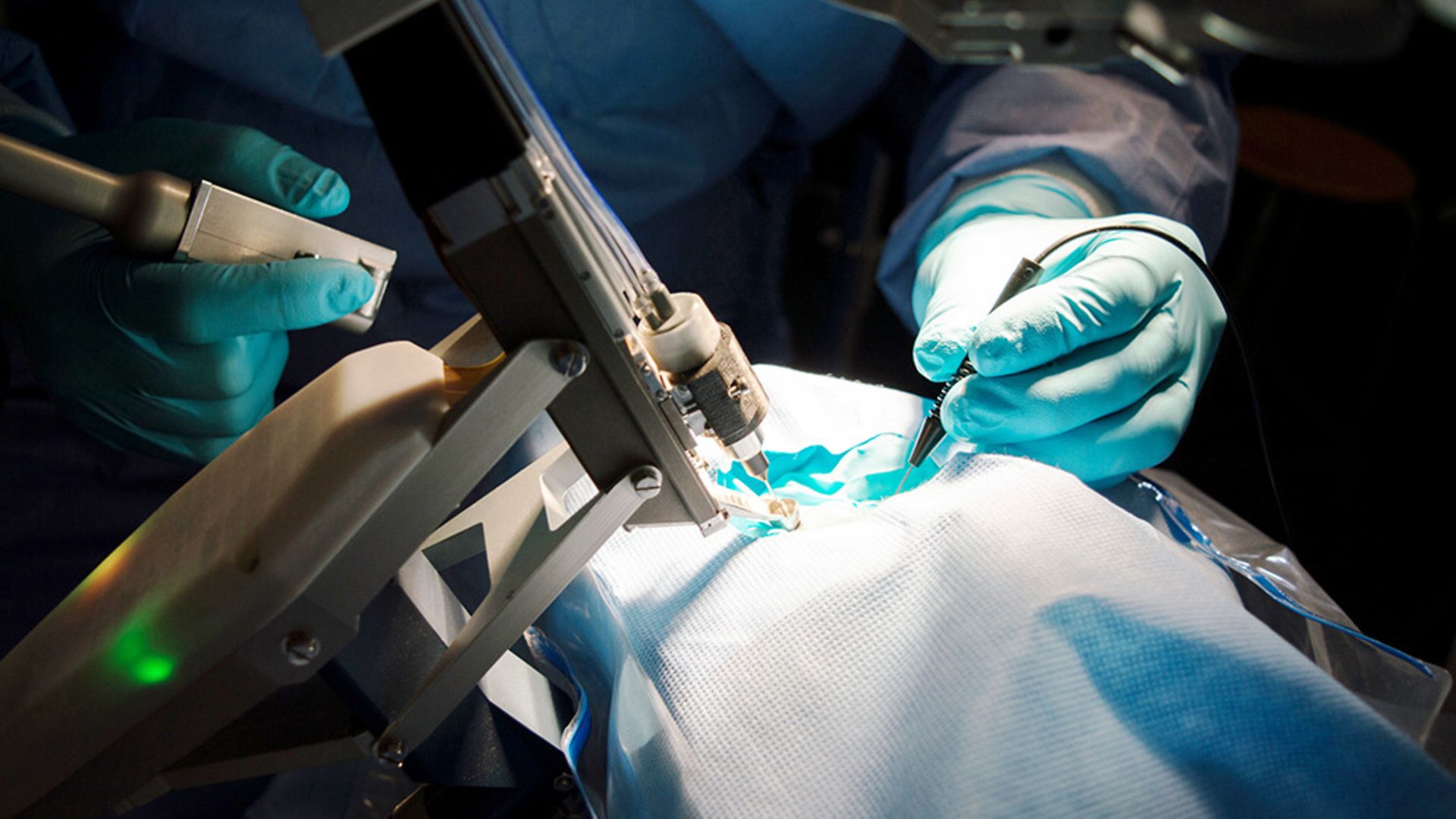 160101-PRECEYES-Surgical-System-Copyright-and-courtesy-Preceyes
