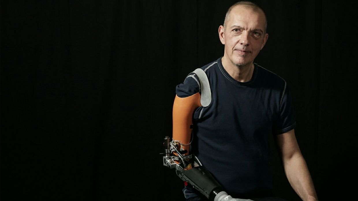 Smart ArM: 人体の限界に挑む | maxon group